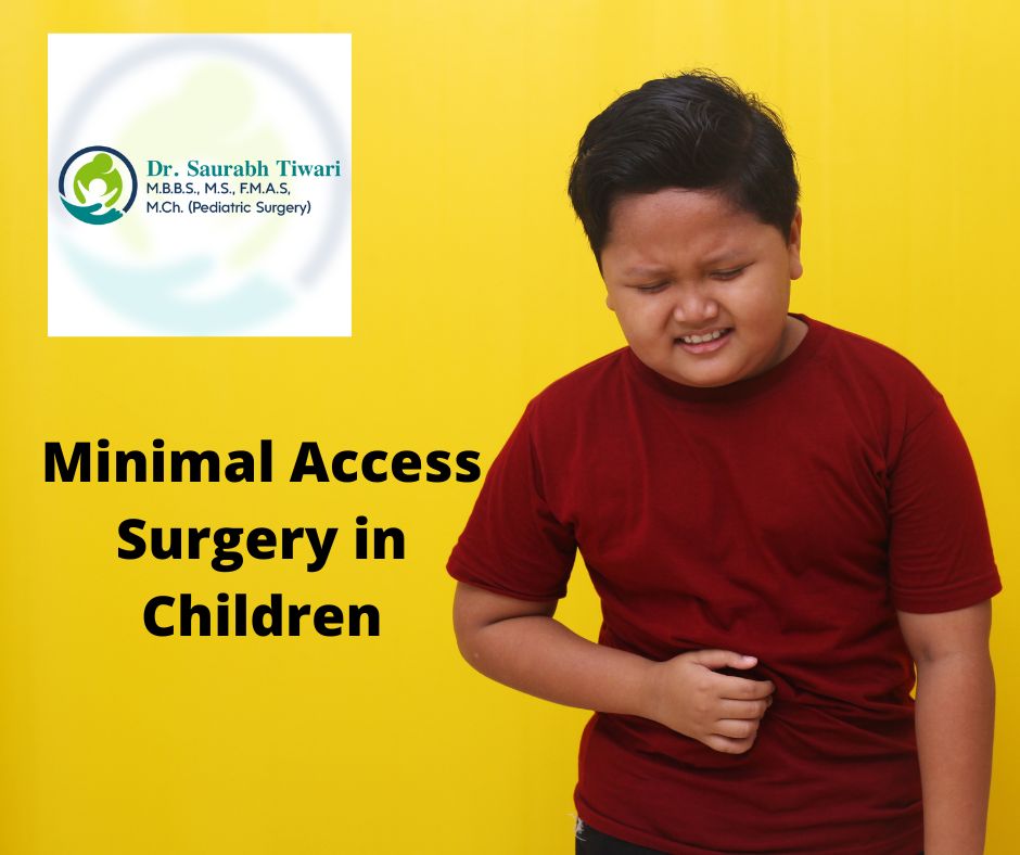 Minimal Access Surgery in Children | Dr. Saurabh Tiwari