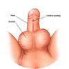 Cystoscopy-1