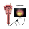 Cystoscopy