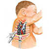 Pediatric Thoracic