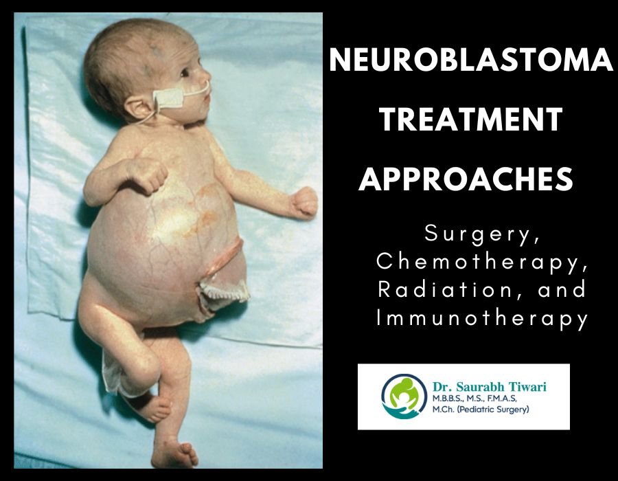 Neuroblastoma Treatment Approaches | Dr. Saurabh Tiwari