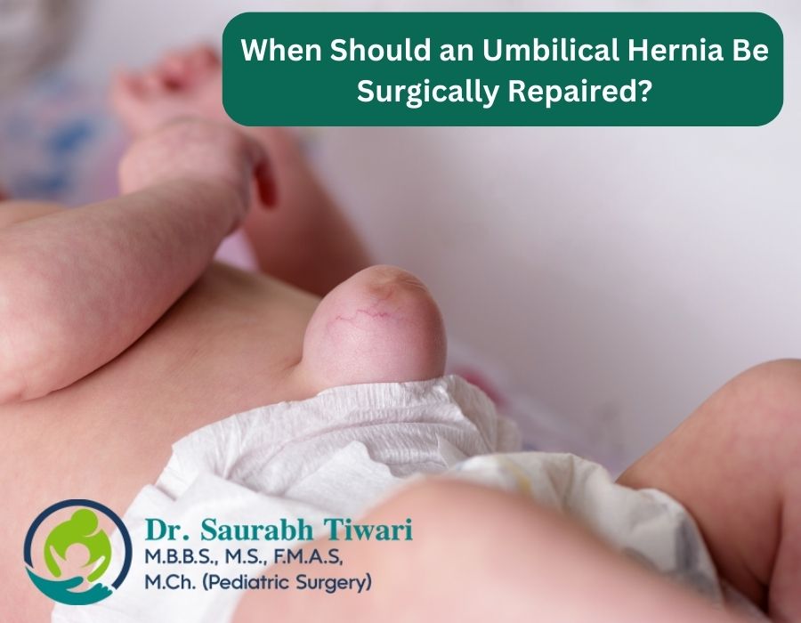 Umbilical Hernia in Babies & Children 