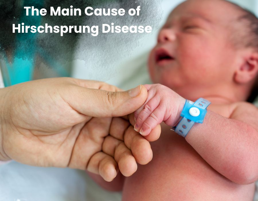 The Main Cause of Hirschsprung Disease