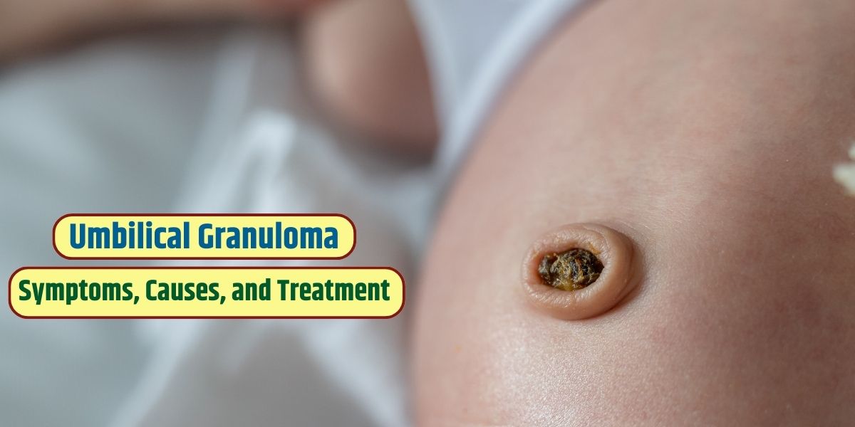 Umbilical granuloma: Symptoms, causes, and treatment