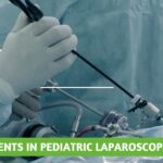 Advancements in Pediatric Laparoscopic Surgery: A Guide for Parents