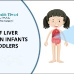 Signs of Liver Problems in Infants