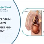 Swollen scrotum in Children - Possible Causes and Treatment