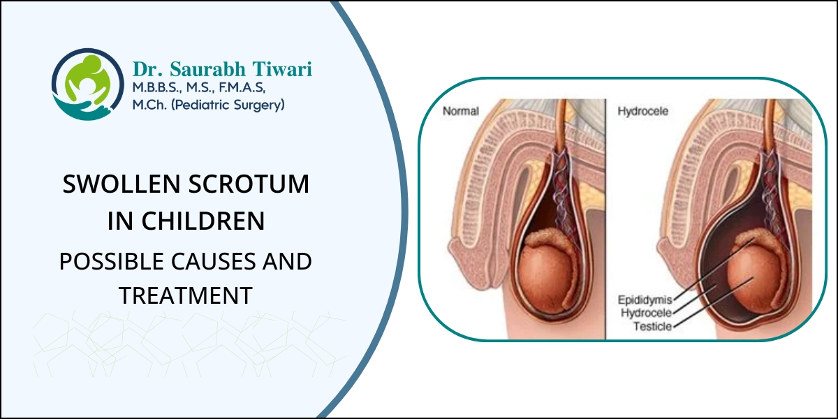 Swollen scrotum in Children - Possible Causes and Treatment