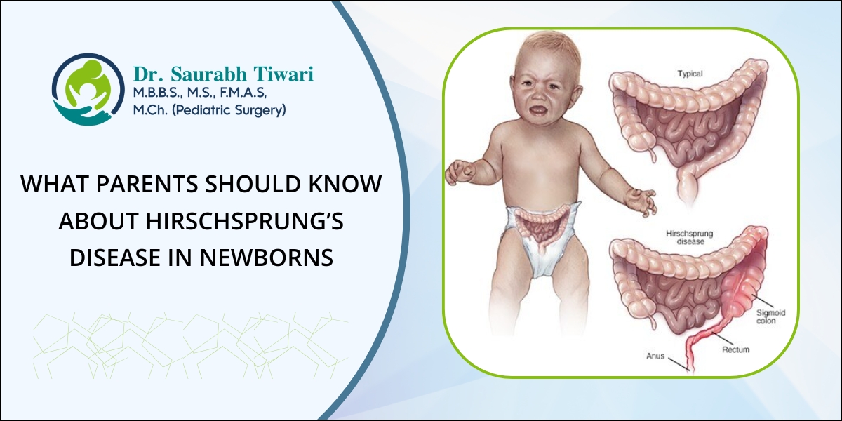Hirschsprung’s Disease in Newborns