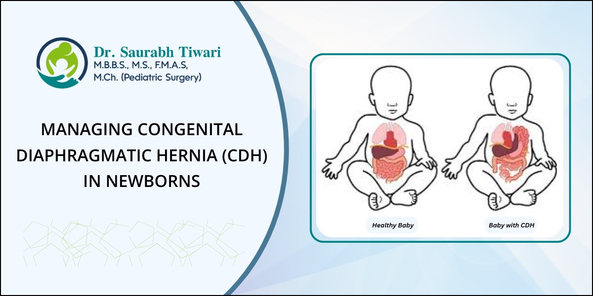 Congenital Diaphragmatic Hernia (CDH)