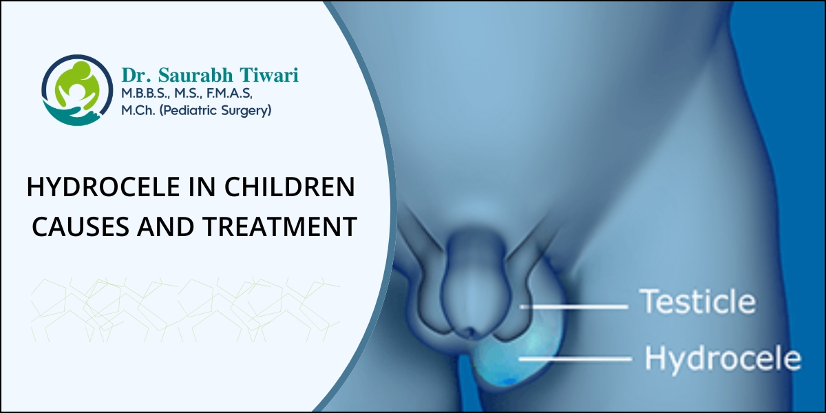 Hydrocele in Children - Causes and treatments